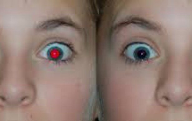 How To Correct Red Eye